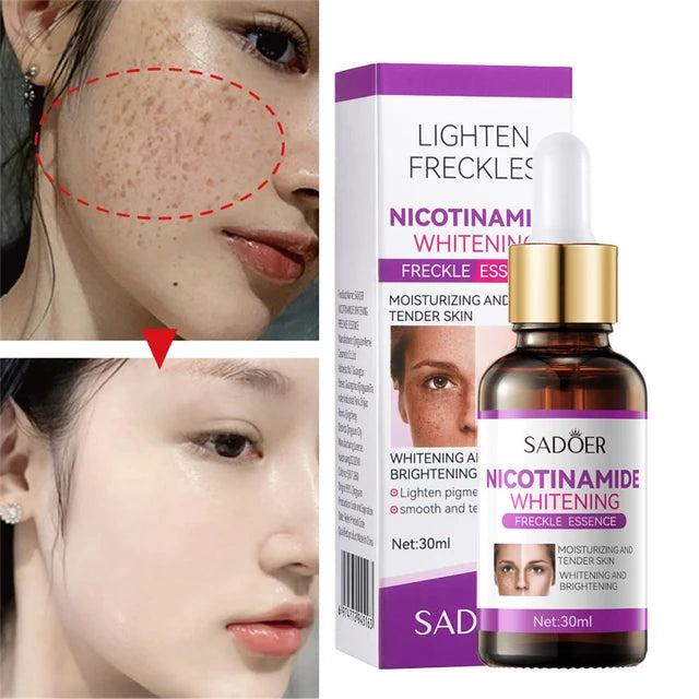 ACLARA LA PIEL 🧖🏻‍♀️ SERUM SADOER NICOTINAMIDA